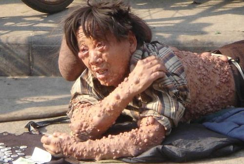 恶心