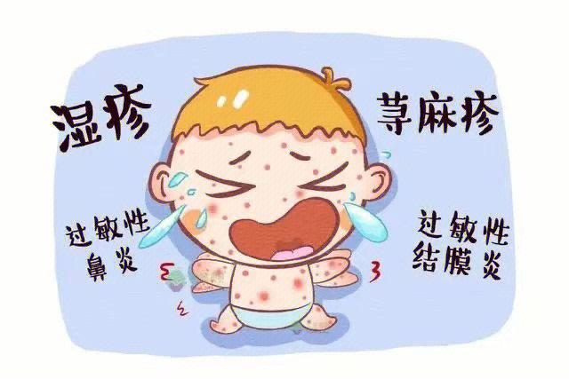 过敏史