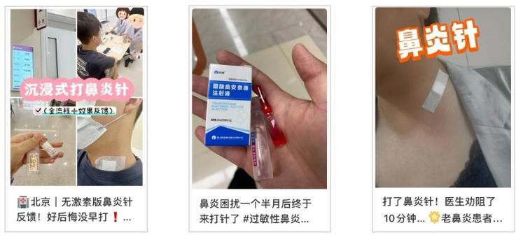 鼻炎针