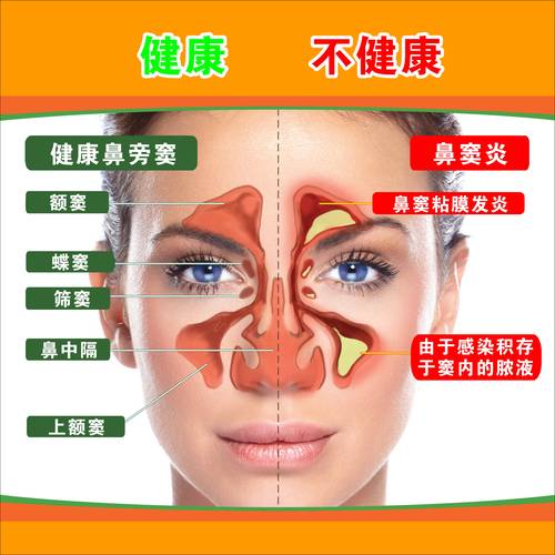 鼻炎治疗