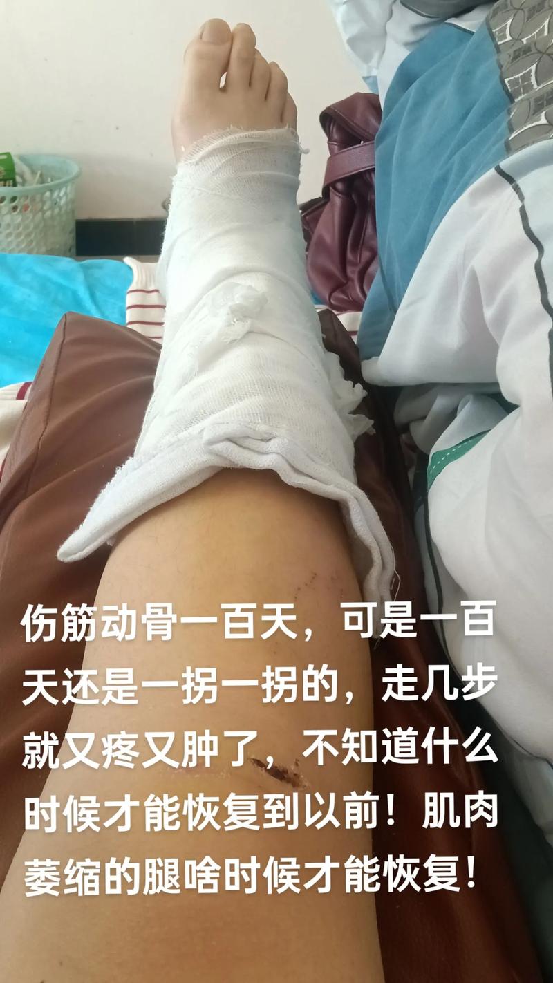 保守治疗