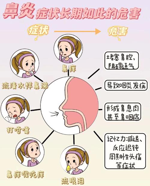 遗传鼻炎