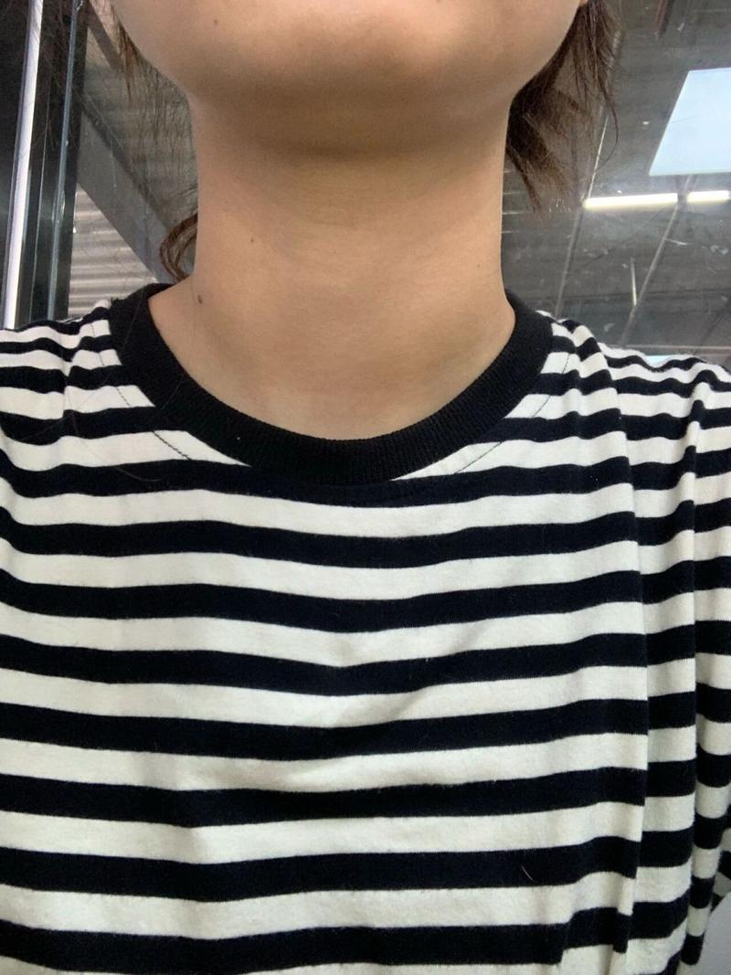 脖子变粗