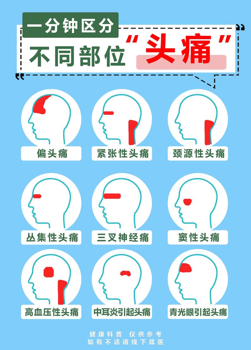 偏头痛