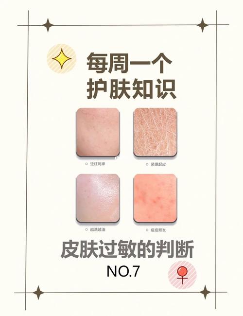 过敏判断
