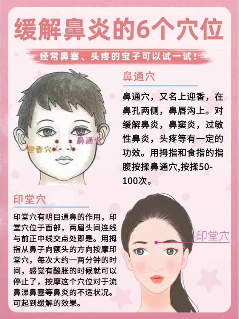 鼻炎特效穴位