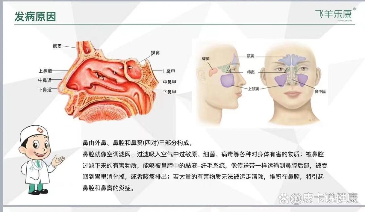 鼻炎普遍原因