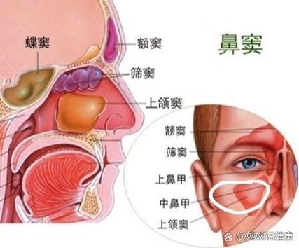 二级鼻炎