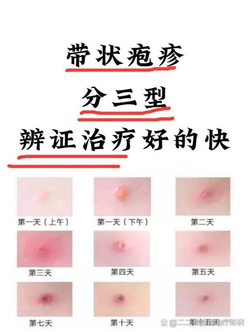 <症状表现>