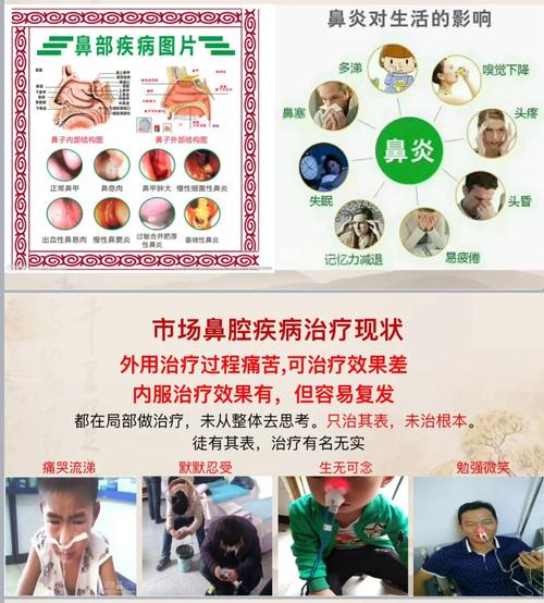 鼻炎治疗棘手