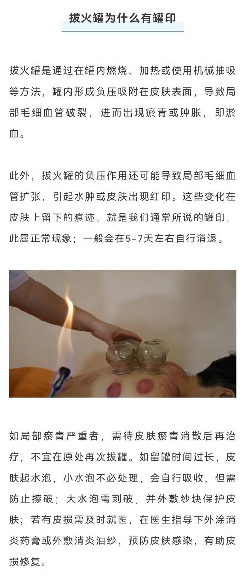 烧水疗法