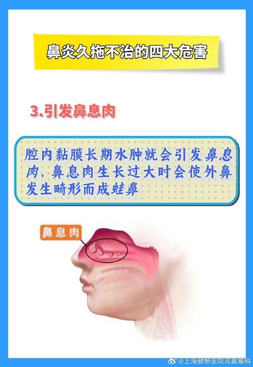 鼻炎长期不治