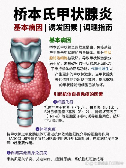 甲状腺炎