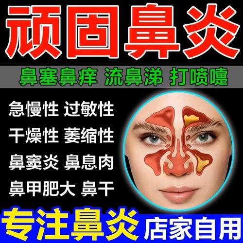泸县鼻炎