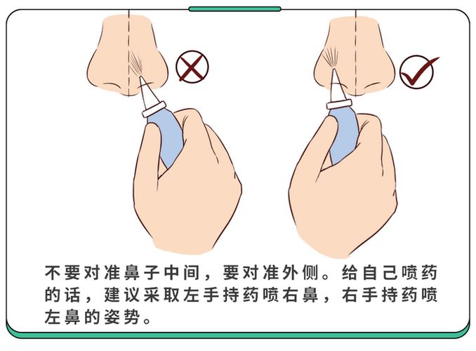 鼻吸入疗法