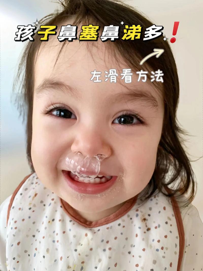 鼻涕多