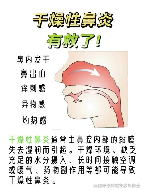 鼻腔干燥