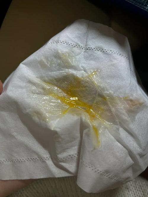 鼻炎鼻涕黄