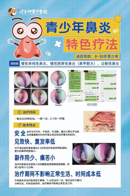 以色列鼻炎疗法
