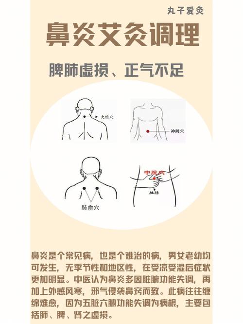光灸治疗鼻炎