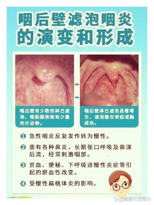 喉咙影响