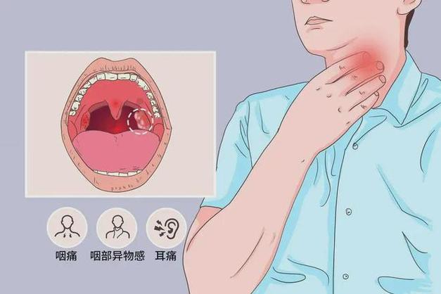 喉咙痒痛