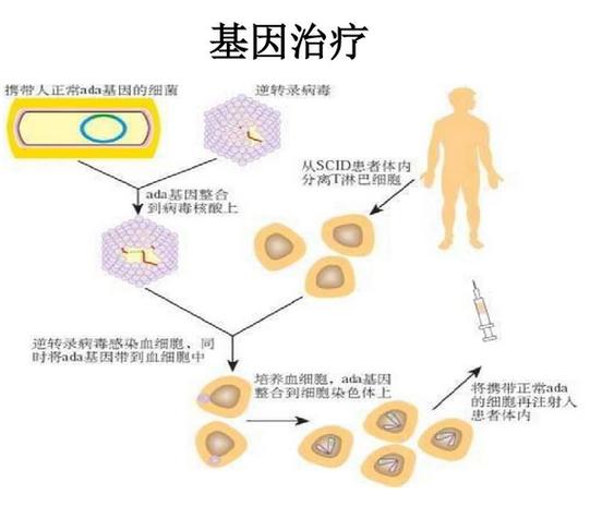 基因疗法