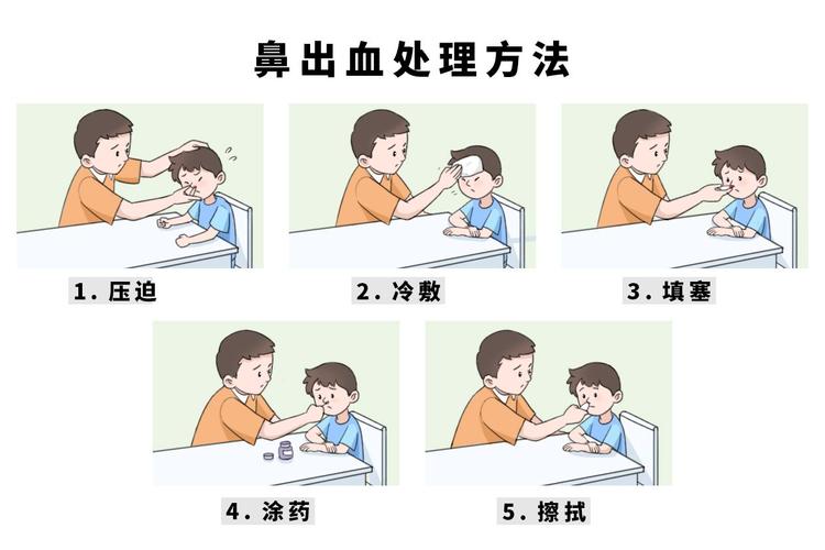 鼻出血治疗