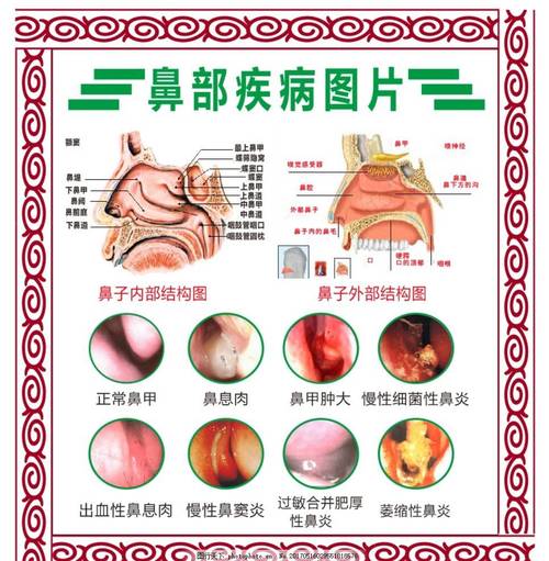 鼻部健康