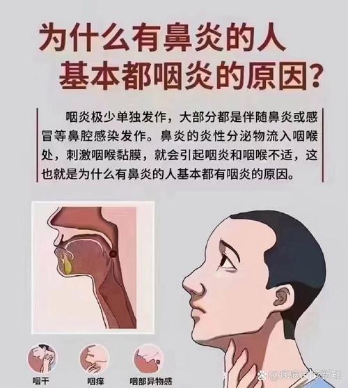 <鼻炎咽喉炎>