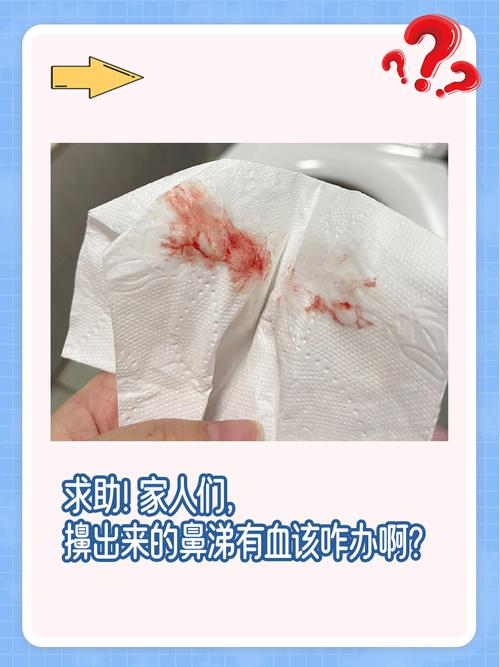 鼻涕带血