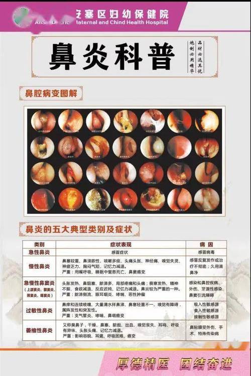鼻炎诊疗服务