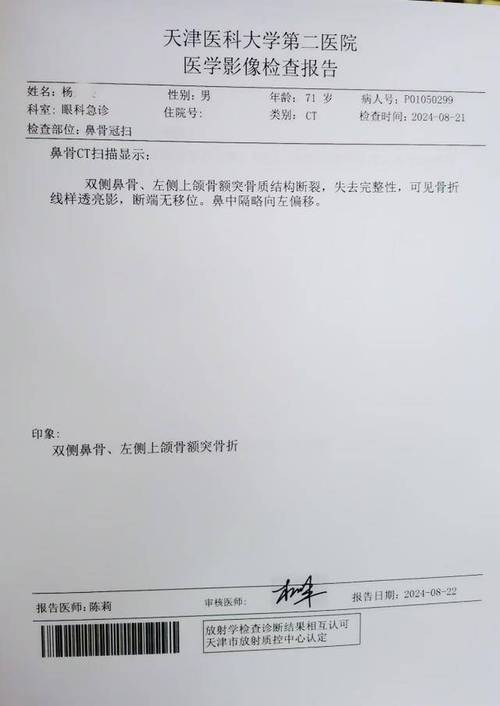双侧鼻血