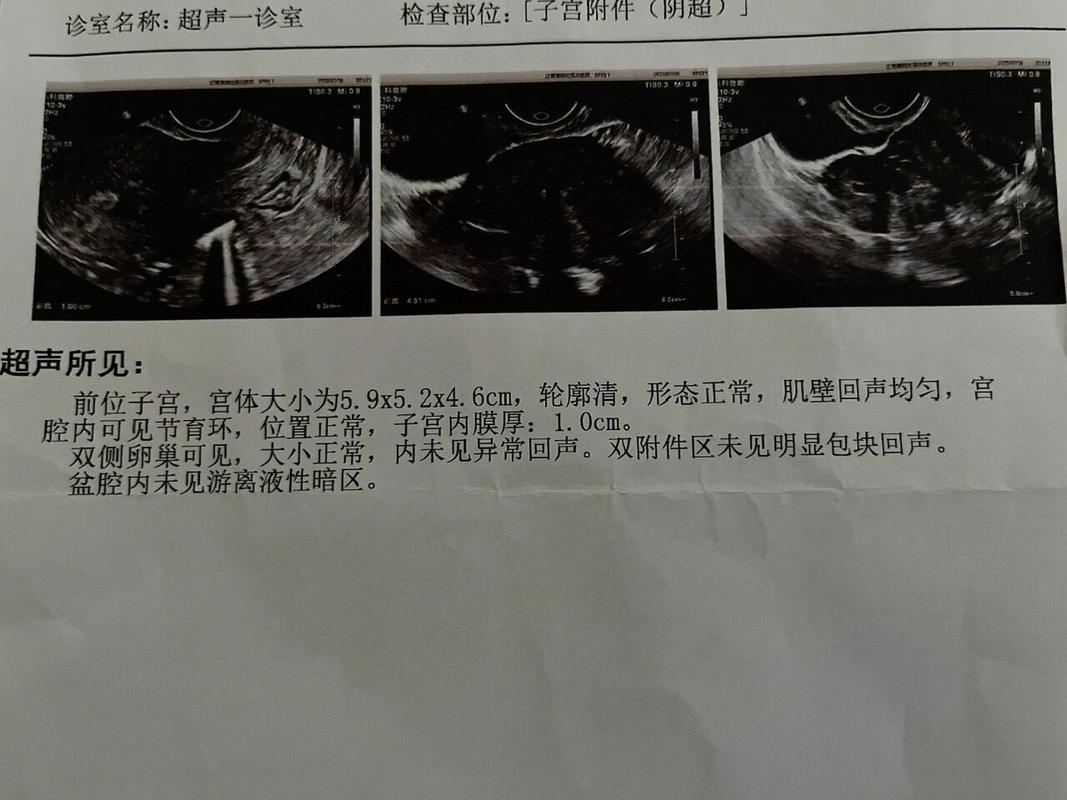 半个月复查