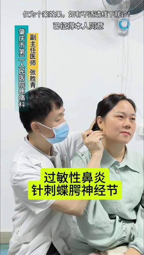 鼻炎针刀治疗