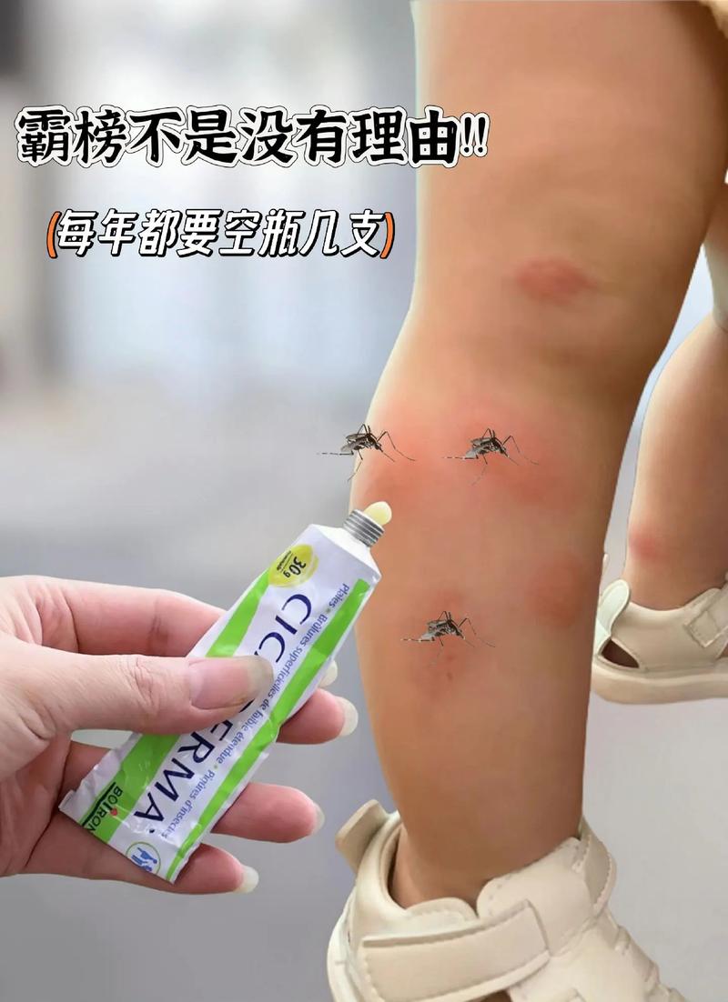 止痒