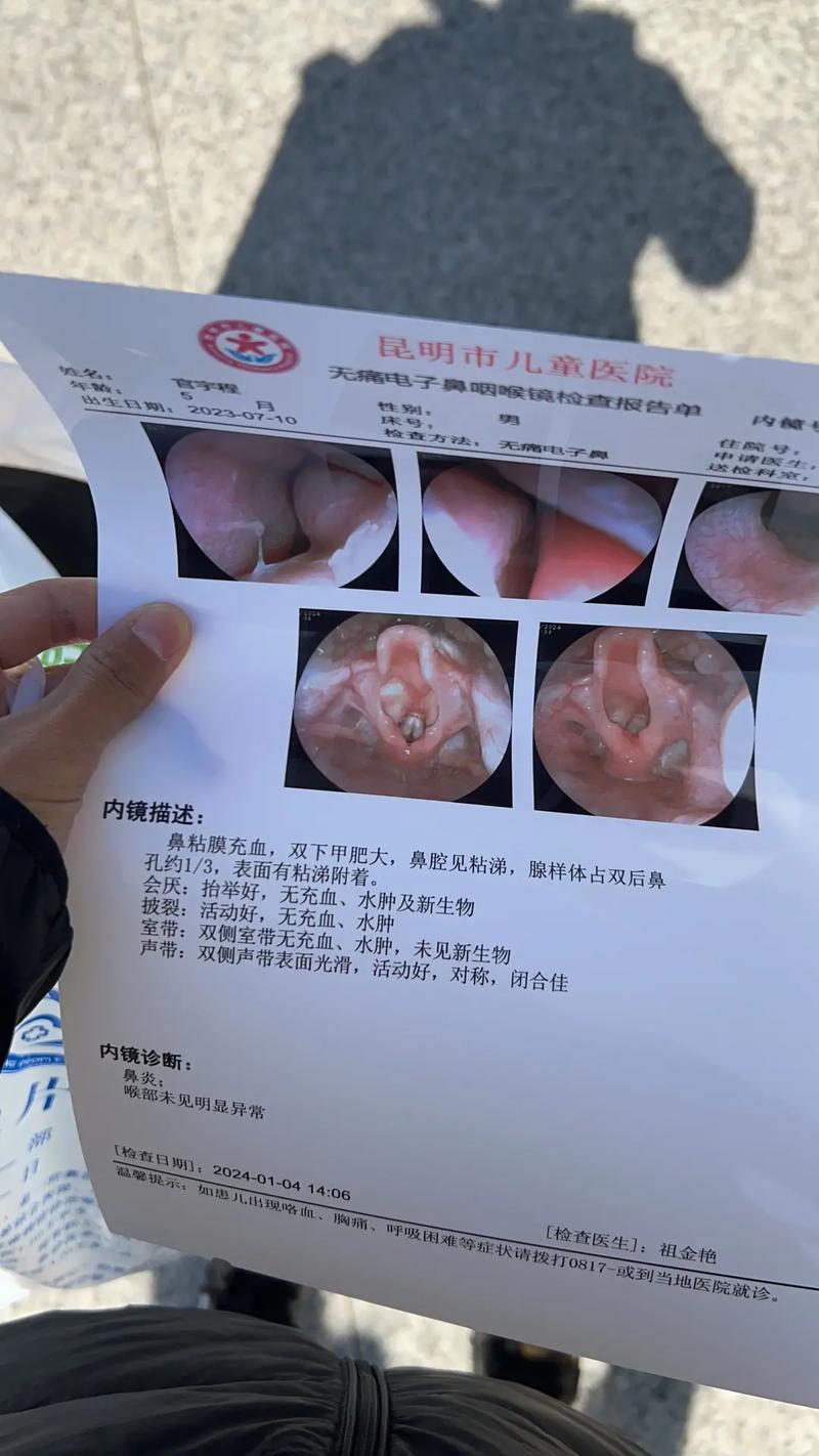  鼻炎检查