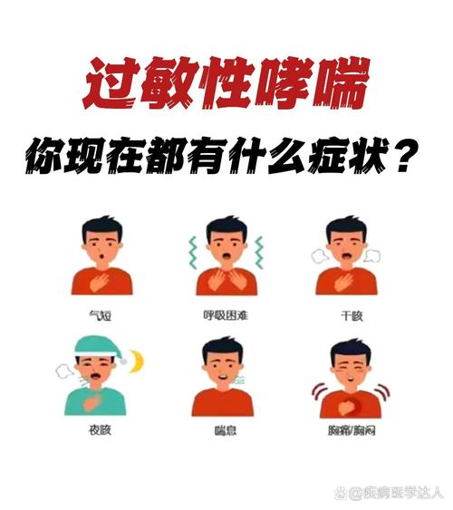 过敏性哮喘