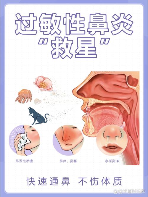 过敏性鼻炎，血性鼻水，预防与治疗