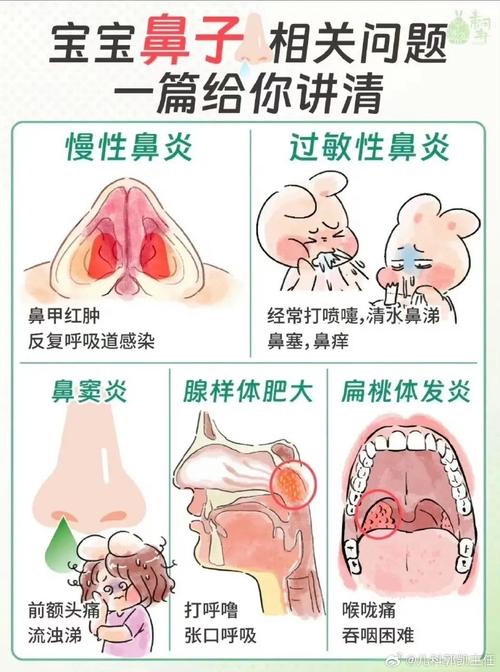 阳虚性鼻炎
