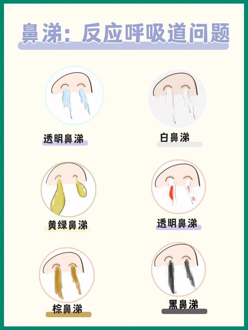 鼻涕颜色揭秘：黄绿色是否意味着鼻炎？