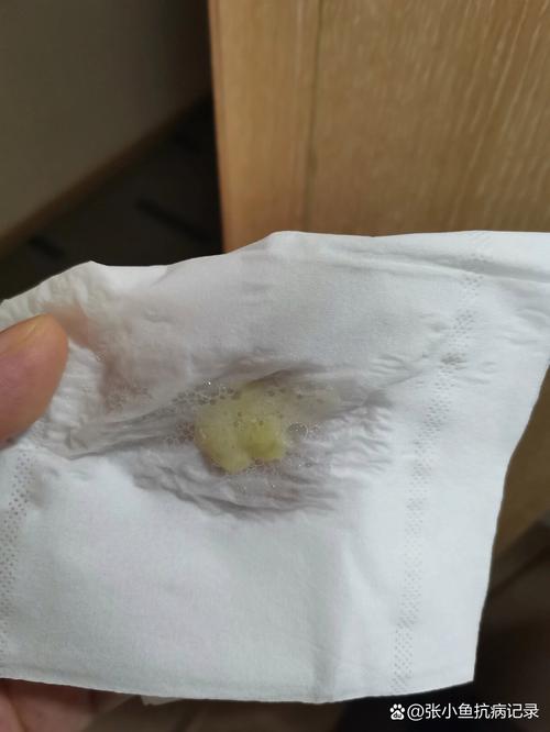  黄痰