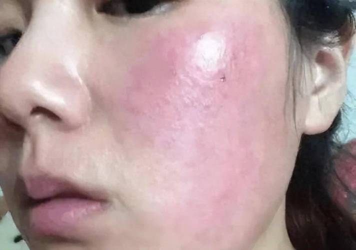 脸颊泛红
