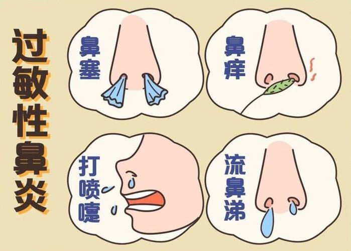 股民性鼻炎