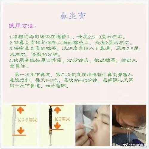 中药膏剂
描述: 本文详细揭秘了龚廷鼻炎馆的独特疗法，包括中药草本熏蒸、穴位按摩、中药膏剂涂抹等。通过实际案例和统计数据展示其综合治疗效果，为鼻炎患者了解该疗法提供参考，助力摆脱鼻炎困扰。