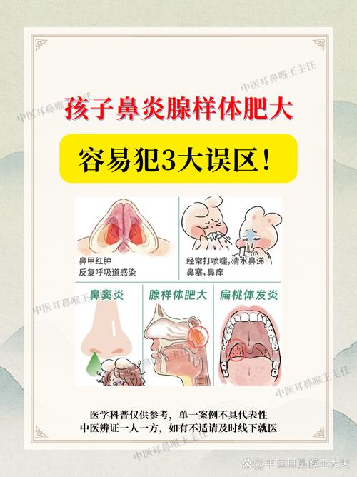儿童腺样体鼻炎