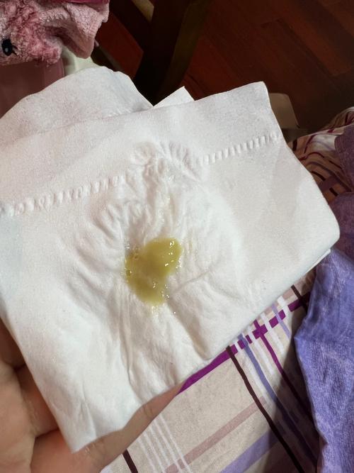 稠涕